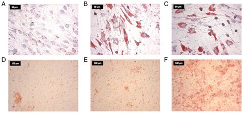 Representative Oil Red O And Von Kossa Staining Images Of Hmscs After