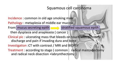 Common Middle Ear Tumors