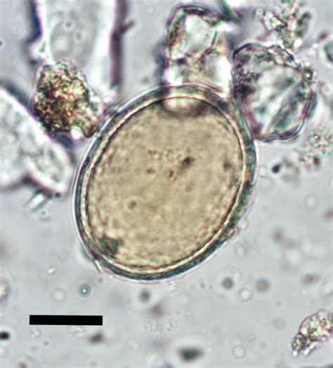 Roundworm Under Microscope