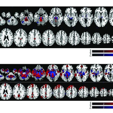 Significant Vta And Sn Functional Connectivity Maps P