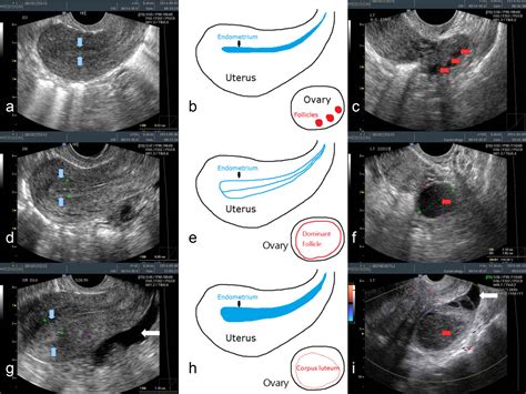 Detection Of Ovulation A Review Of Currently Available Methods Su 2017 Bioengineering