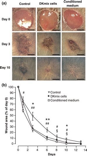 Dkmix Cells And Their Conditioned Medium Accelerate Dermal Excisional