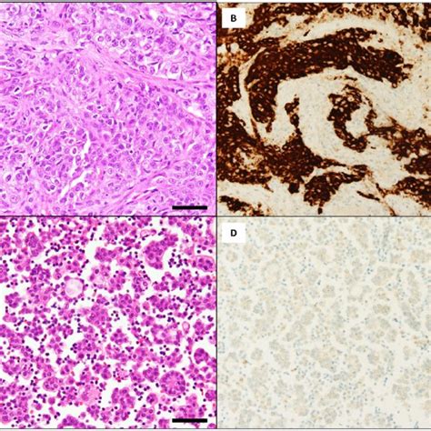 Pathological Examinations Of Hematoxyline And Eosin Staining A C And