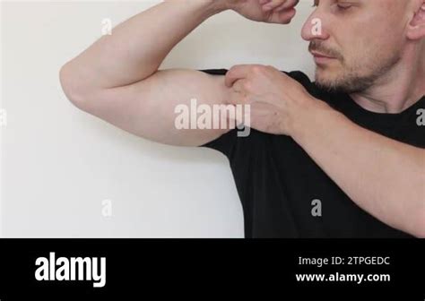 Armpit Allergy Young Man Shows And Scratches Irritation By Hand On