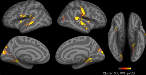 Inflated Brain Image Functional Connectivity With The Left Vta Download Scientific Diagram