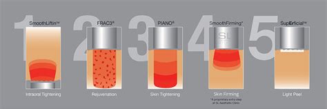 How Fotona 4d Laser Reverses The Signs Of Ageing Sl Aesthetic Clinic