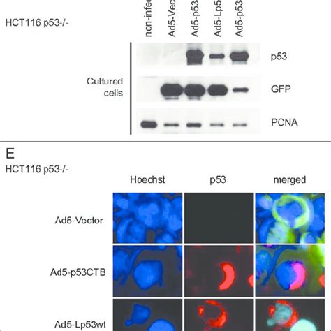 Adenovirally Delivered Mitochondrial P53 Efficiently Induces Apoptosis