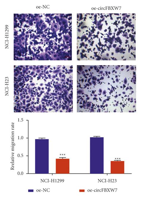 Overexpression Of Circfbxw Reduced Cell Proliferation Migration And