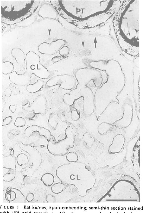 Figure 3 From Regional Distribution Of N Acetyl D Galactosamine