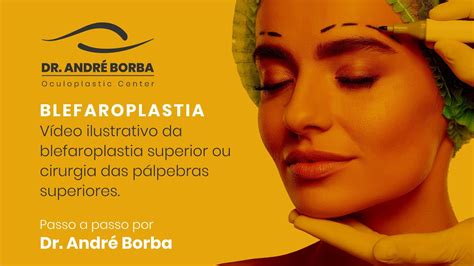 Blefaroplastia ou cirurgia das pálpebras superiores Passo a passo por