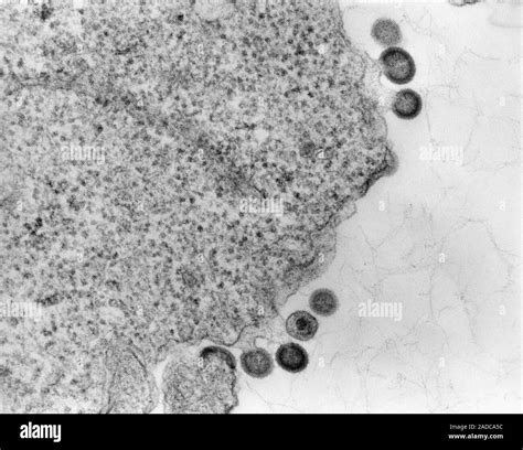 Hiv Infection Transmission Electron Micrograph Tem Mature Virus And