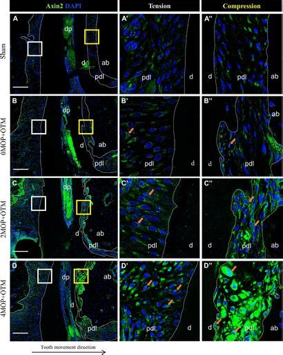 Frontiers Effect Of The Number Of Micro Osteoperforations On The Rate