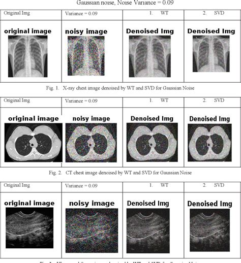 Figure 1 From Efficient Denoising Of Multi Modal Medical Image Using