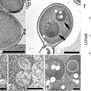 Electron Microscopy Of Wild Type Cells And Lipid Droplet Formation