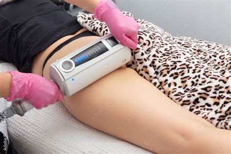 The Masseur Does A Massage Using Anti Cellulite Massage Machine With