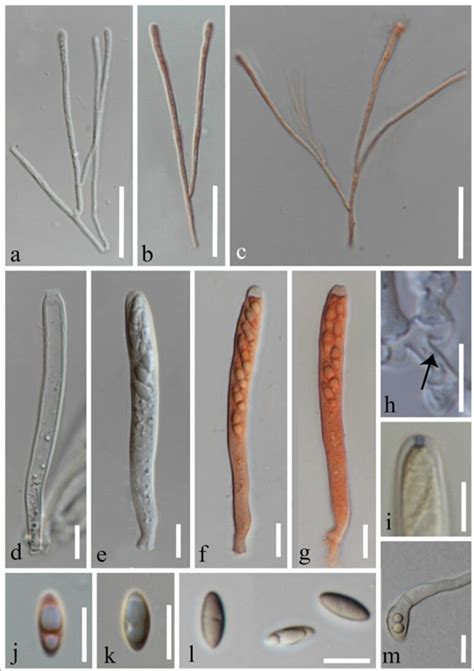 Lambertella Tectonae Mflu Holotype A C Filiform