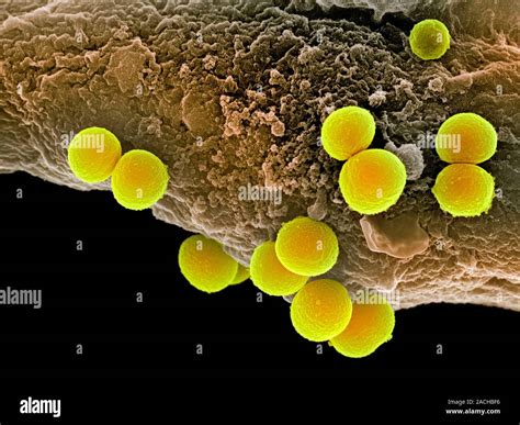 Staphylococcus Aureus Bacteria Coloured Scanning Electron Micrograph