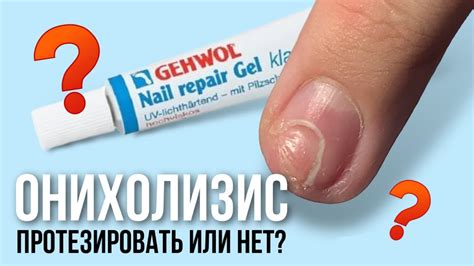 Ногти против гололеда, часть 2/ можно ли закрыть онихолизис материалом ...