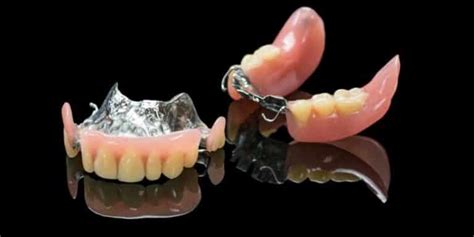 Prótesis Removibles: Tipos y cuidados | Solución Dental ® Lima - Perú