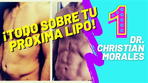 Lipoescultura Lipo HD 3D 4D Lipotransferencia El Dr Christian