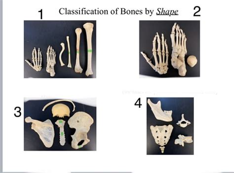 Human Anatomy And Physiology Lab Chapter Axial Bones Flashcards