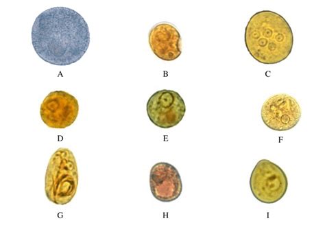 Giardia Lamblia Cyst Under Microscope | Bruin Blog