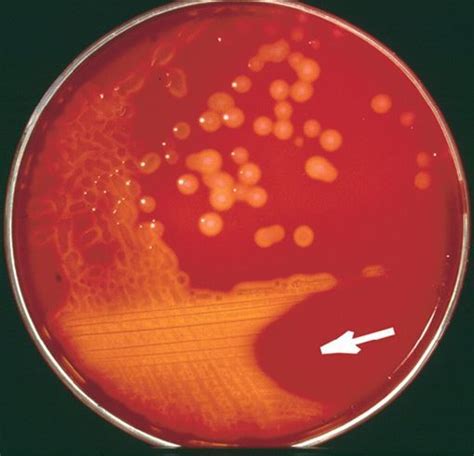 Streptococcus Pyogenes Gas Characteristics Diseases Tests • Microbe Online