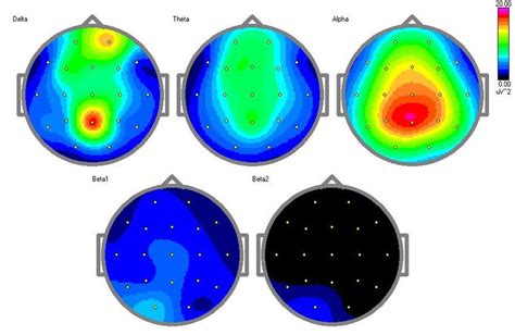 A Spectral Power Plots µv 2 Delta 0 5 4 0 Hz Theta 4 8 Hz Alpha