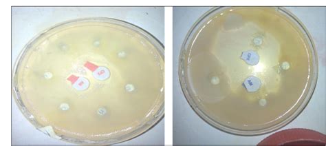 Figure From Isolation Of Antibiotics Producing Bacteria From Marine