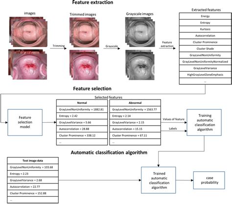 Ml Model Training Process For Cervical Cancer Classification The