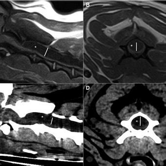 Midsagittal A And Transverse B T Weighted Spin Echo Image And