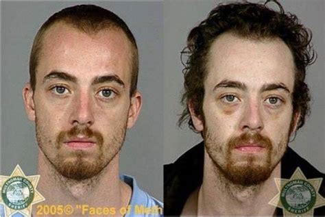 Faces Of Meth 20 Pics