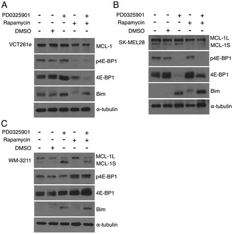 Combined Inhibition Of Mek And Mtor Has A Synergic Effect On Angiosarcoma Tumorgrafts