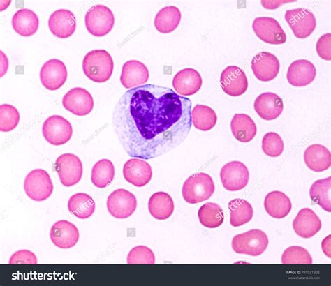 Peripheral Blood Smear Showing Red Cells Stock Photo 791031202 ...