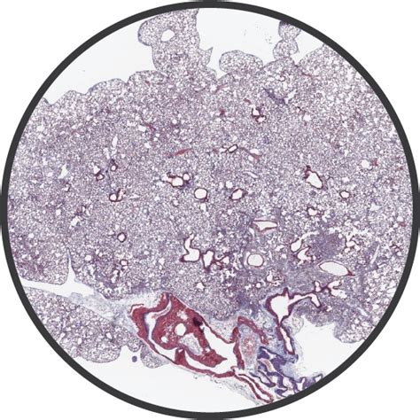 fibrosis research services