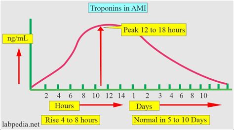 Cardiac Marker Part 3 Troponin T And Troponin I Labpedia Net