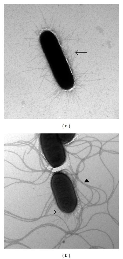 Observation Of Salmonella Enterica Subsp Enterica Serovar Typhimurium