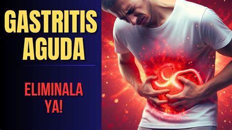 Gastritis Aguda Inflamacion Del Estomago Causas Signos Síntomas