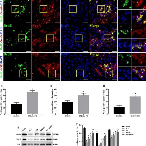 PD Promoted Neuronallike Differentiation Of BMSCs In The Injured