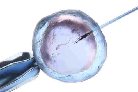 What Is Intrauterine Insemination Iui Treatmentsuccess And Advantages