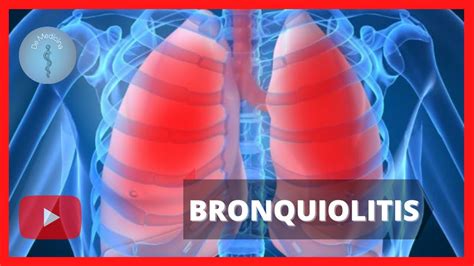 Bronquiolitis Youtube