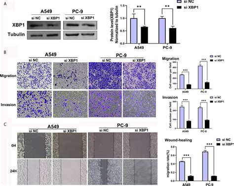 Frontiers XBP1 IGFBP3 Signaling Pathway Promotes NSCLC Invasion And