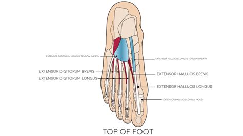 Extensor Tendinopathy Nhs Lanarkshire