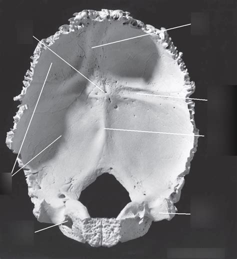 Skull Osteology Occipital Bone 2 Diagram Quizlet