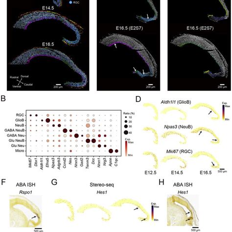 Pdf Spatiotemporal Transcriptomic Atlas Of Mouse Organogenesis Using