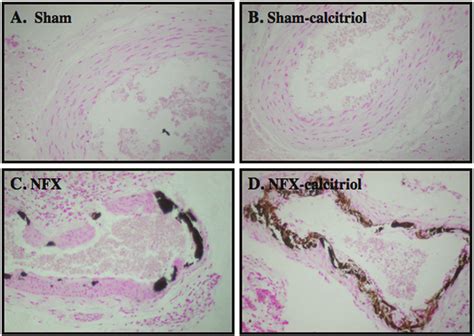 Von Kossa Stained Sections Of The Aorta In Sham Operated Rats A In Download Scientific