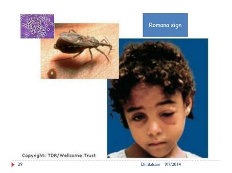 Ppt Trypanosomiasis Powerpoint Presentation Free Download Id4042473