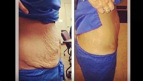 Have You Tried That Crazy Wrap Thing Tighten Tone And Firm In As