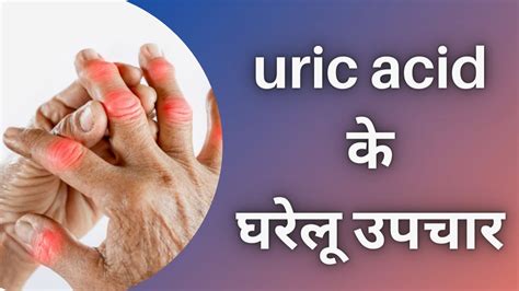 Uric Acid Ka Gharelu Ilaj यूरिक एसिड का रामबाण इलाज Uric Acid Treatment Youtube