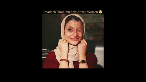 Marzieh Ebrahimi Iranian Women You Should Know 😔😢 Shorts